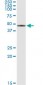 SERPINB2 Antibody (monoclonal) (M08)